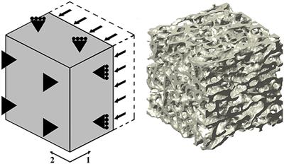 Using Non-linear Homogenization to Improve the Performance of Macroscopic Damage Models of Trabecular Bone